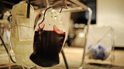 Soluție salvatoare: cum ar putea fi schimbată grupa de sânge