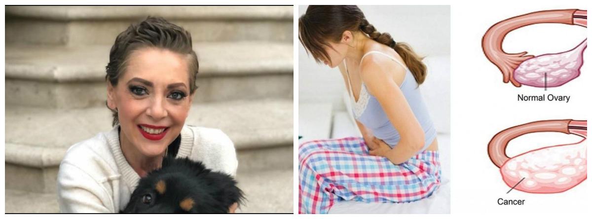 Ce este cancerul ovarian, boala care a rupus-o pe actrița Edith Gonzalez! Atenție mare la aceste simptome!&nbsp;