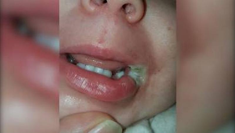 Un copil din Vaslui a atins cu limba un încărcător de telefon. Elevul a fost dus de urgență la spital