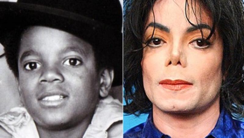 Ce a fost de fapt ”clorul” care l-a făcut Michael Jackson, din negru alb: ”Nu se putea privi în oglindă!” Fiul lui, Prince, suferă de aceeași boală