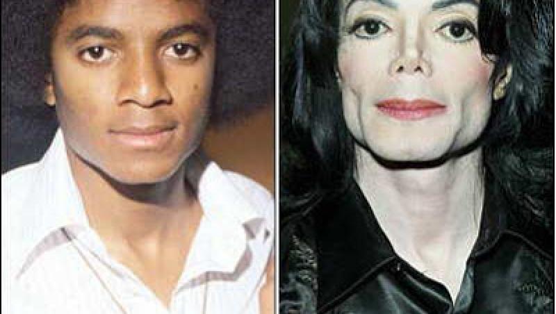 Ce a fost de fapt ”clorul” care l-a făcut Michael Jackson, din negru alb: ”Nu se putea privi în oglindă!” Fiul lui, Prince, suferă de aceeași boală