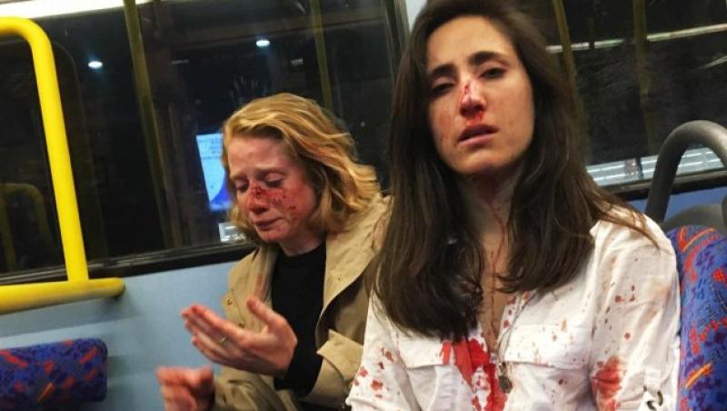 Umilite, bătute și jefuite, într-un autobuz, pentru că au refuzat să se sărute în fața unor bărbați: „Sub mine începuse să se formeze o baltă de sânge