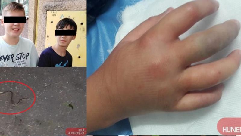Alex a fost mușcat de o viperă într-un parc din Deva. Mama e disperată: „Tremură, mâna e umflată de venin