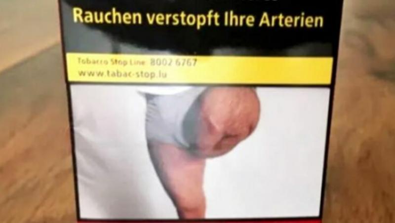 Un bărbat a rămas șocat atunci când a văzut că o poză cu piciorul lui amputat este folosită pentru pachetele de tigări fără consimțământul lui