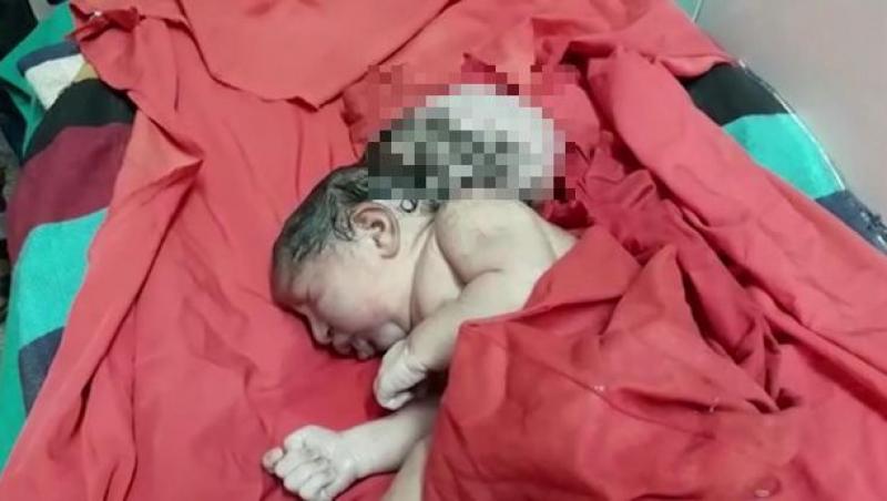 Un bebeluș s-a născut cu trei capete! Familia lui este în stare de șoc! „Arată ca un extraterestru”. Imagini tulburătoare!