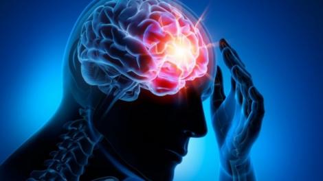 Accidentul vascular cerebral poate fi tratat cu ajutorul neurotehnologiei