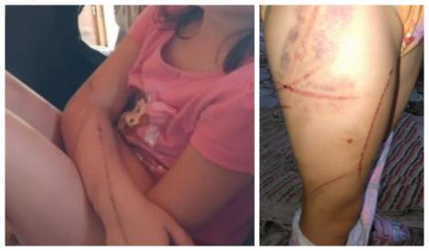 FOTO Imagini terifiante. Bătute cu biciul fără milă! Fete de șase, opt și unsprezece ani agresate de propriul tată!