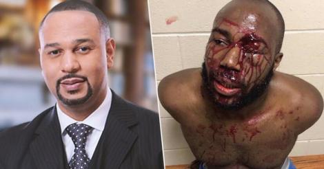 Un avocat a acuzat mai multi politiști pentru că au batut brutal un client de-al lui: "L-au răvășit până când nu mai avea haine pe el"
