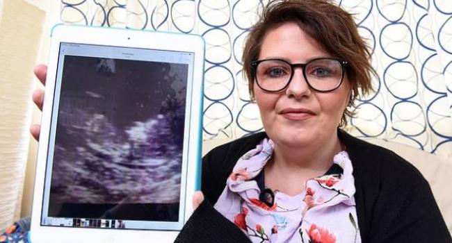 S-a prăbușit din senin și a fost dusă de urgență la spital. Medicii au crezut că are un chist ovarian, dar au fost șocați. &bdquo;Avea dinți, păr și unghii&rdquo;