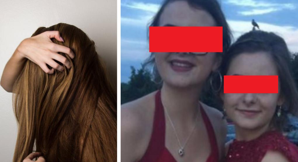 A murit după ce și-a m&acirc;ncat părul din cap! &Icirc;n timpul autopsiei medici au descoperit ceva șocant!