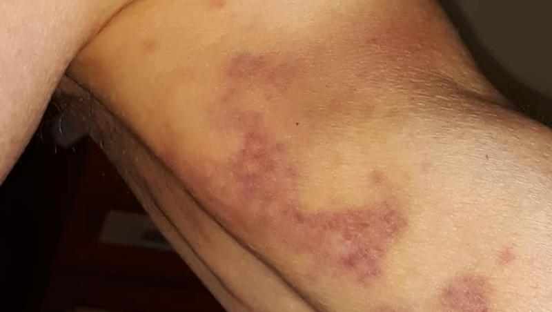 Un bătrân a fost lovit de medici, la UPU Sighetu Marmației! „Rușine!”. Atenție, imagini ce vă pot afecta emoțional! Foto