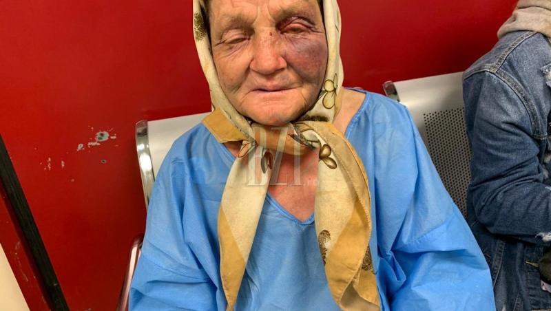 O bătrână a fost bătută cu bestialitate în gara din Iași, femeia își aștepta nepoata. „Au început, maică, să mă bată cu pumnii și picioarele, să țipe și să râdă”