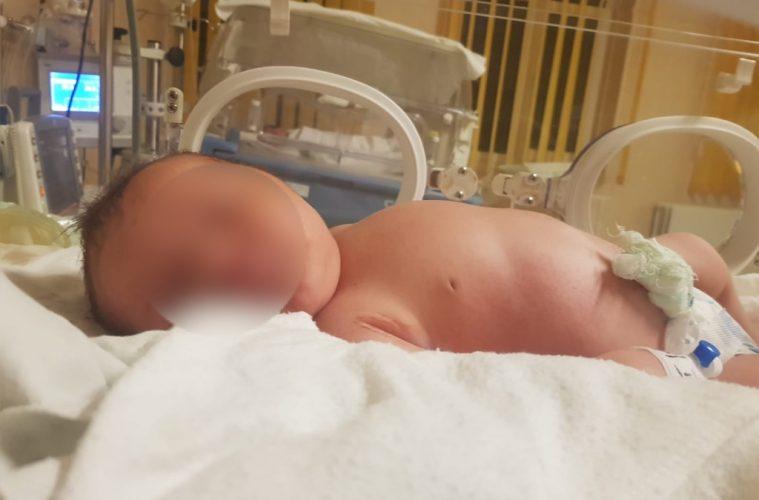 Caz șocant la Botoșani! O femeie a adus pe lume un copil macrosom