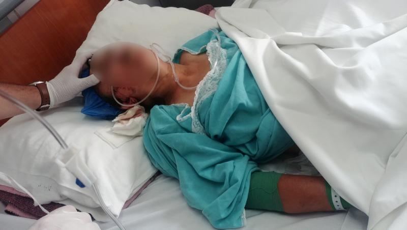A fost găsită beată și avea rănile pline cu viermi. O femeie a fost transportată de urgență la spital din Iași - FOTO