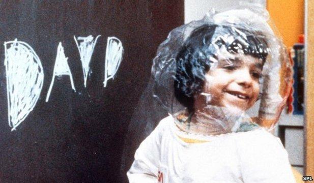 Copiii "bulă" suferă de o boală gravă care &icirc;i obligă să trăiască toată viața &icirc;n pungi de plastic! Tratamentul presupune &icirc;nlăturarea măduvei osoase