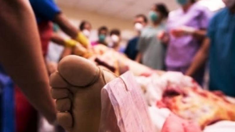 Mărturii dintr-un spital românesc. Un medic întreabă familia unei victime dacă vrea să-i doneze organele: 