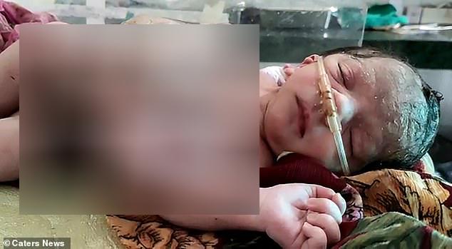 O femeie a născut natural un copil cu patru m&acirc;ini și patru picioare! Cum explică medicii acest caz ce a făcut furori &icirc;n lume