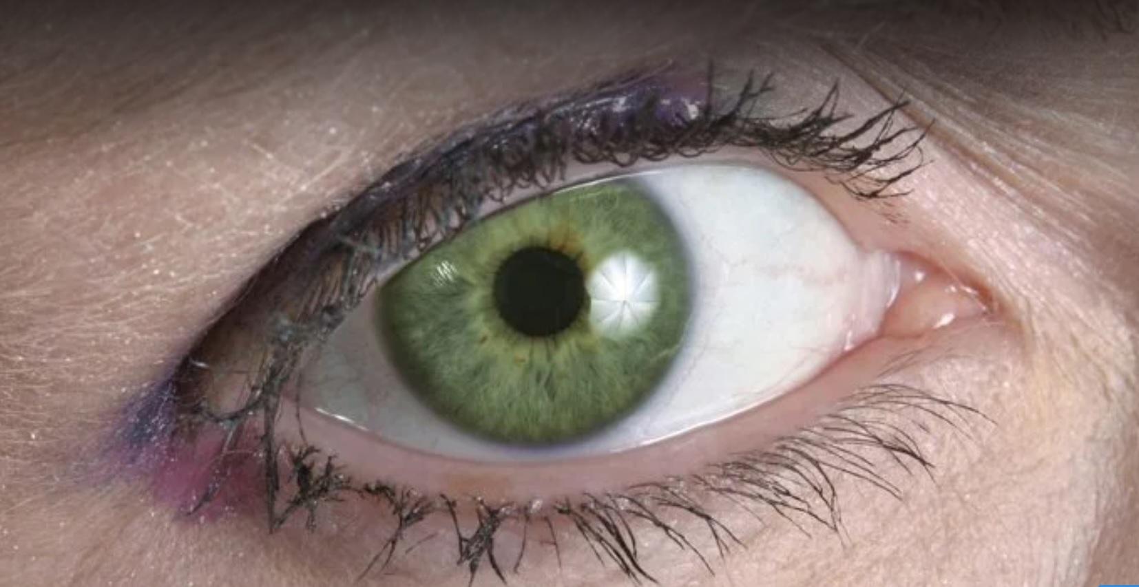 drain Pen pal lose yourself Cele opt culori de ochi rare care există în lume. Află de ce ai tăi nu sunt  așa | Antena 1
