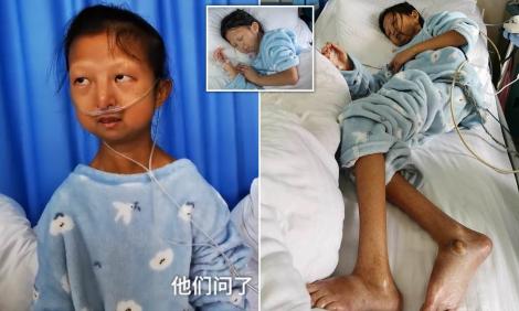 Tabloul sărăciei din China: O studentă a murit după ce s-a hrănit cinci ani doar cu orez și ardei iuți
