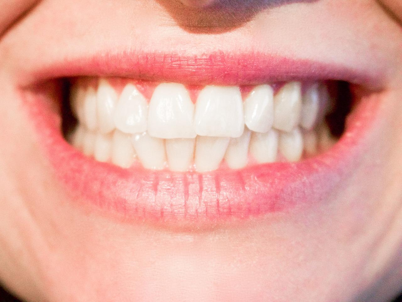 Cum să-ți albești dinții în mod natural și să ai un zâmbet de Holllywood, folosind doar ingrediente naturale și la îndemâna oricui
