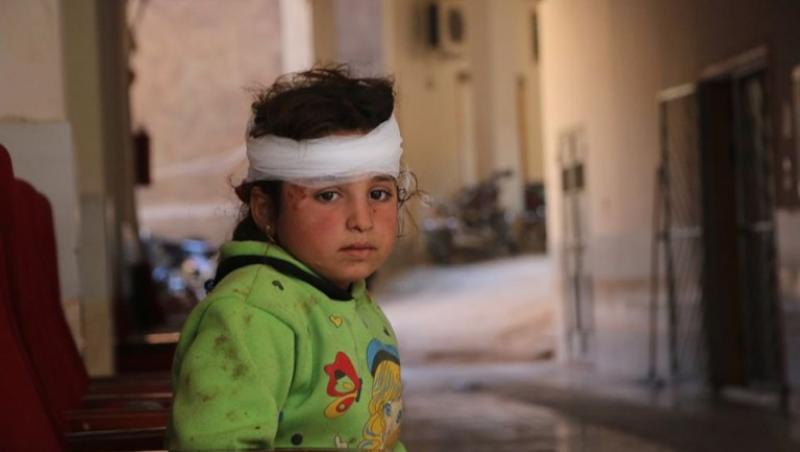 Copil rănit în Siria.