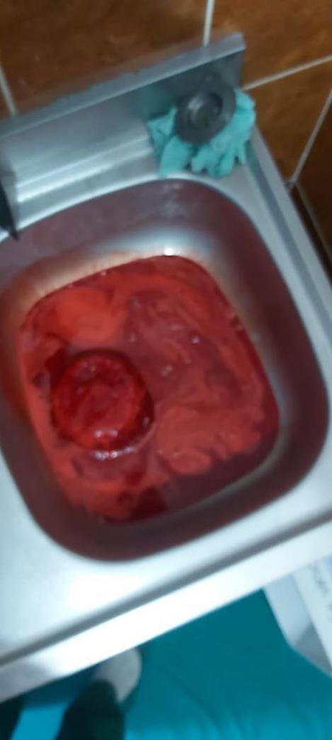 Bombă ecologică: „Mii de litri de sânge contaminat, aruncate ZILNIC în sistemul de canalizare”! Practici criminale, în spitalele din România