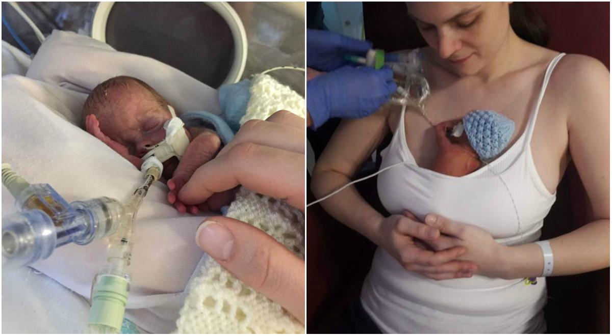 Inima i s-a oprit la c&acirc;teva momente după ce a venit pe lume. După 40 de minute, a fost readus la viață, cu ajutorul unui &bdquo;instrument&rdquo; neconvențional