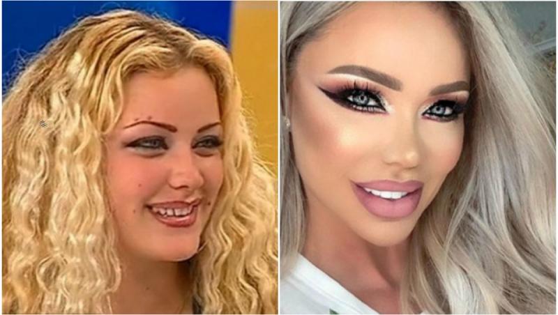 Câte operații estetice are Bianca Drăgușanu