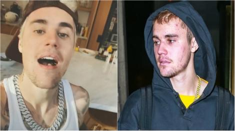 Justin Bieber a fost diagnosticat cu o boală cumplită! Toți credeau că se droghează, dar el se lupta cu moartea: „Mi-au fost afectate funcțiile creierului”
