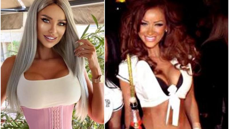 Vedete din România înainte și după operații estetice. Ele au recunoscut că au apelat la chirurgia plastica