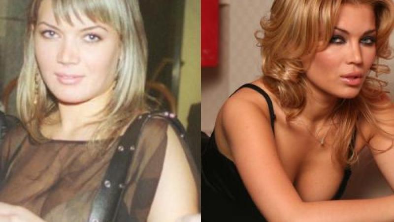 Vedete din România înainte și după operații estetice. Ele au recunoscut că au apelat la chirurgia plastică