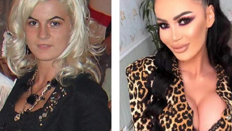 Vedete din România înainte și după operații estetice. Ele au recunoscut că au apelat la chirurgia plastică