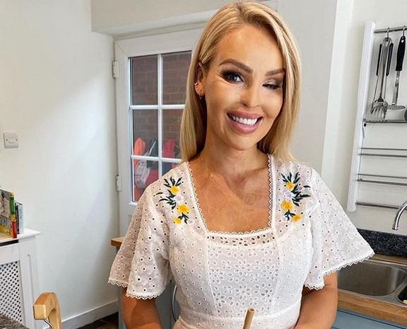 Katie Piper, femeia cu peste 400 de operații de reconstrucție, mesaj emoționant. Povestea atacului asupra ei și cum arată acum