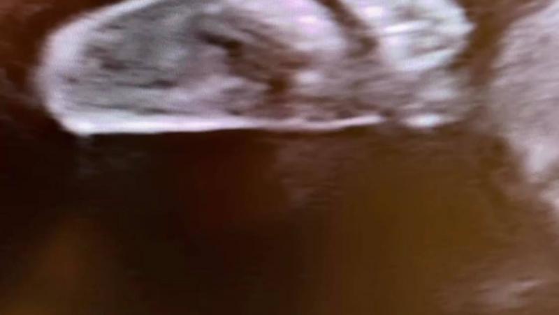 Gina Pistol a arătat ecografia bebelușului ei. Ce mesaj emoționant însoțește imaginea cu fetița