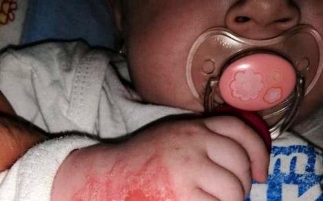 „Au chinuit-o”! Cum a ajuns să arate un bebeluș de cinci luni, internat o săptămână într-un spital românesc. Imagini terifiante, publicate de mamă
