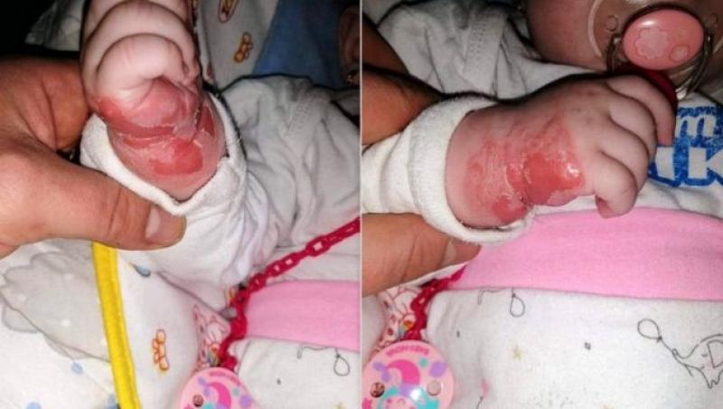 Cum a ajuns să arate un bebeluș de cinci luni, internat o săptămână într-un spital românesc
