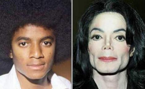 Autopsia lui Michael Jackson: Oasele erau zgâriate de ace, era plin de tăieturi pe spate și avea genunchii tumefiați. Detalii sumbre despre trupul neînsuflețit al Regelui Pop