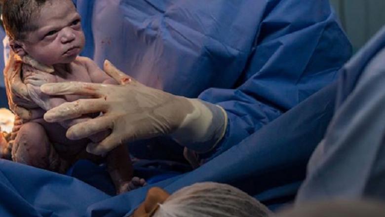 Cel mai faimos nou-născut! Cum a fost surprins de aparatul de fotografiat, imediat după naștere