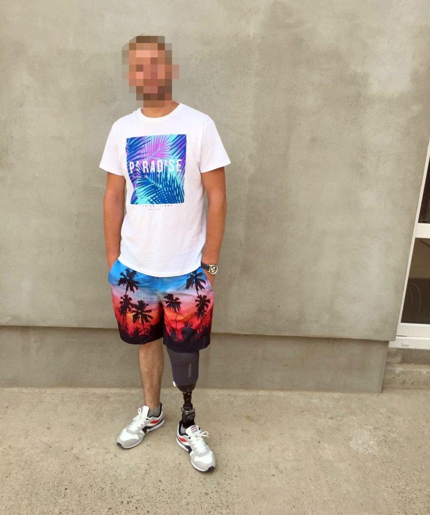 Și-a pierdut un picior, l-a părăsit iubita, a crezut că pentru el viața s-a sf&acirc;rșit, &icirc;nsă după cinci ani a devenit milionar &icirc;n lire sterline