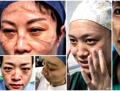 Medicii din China care salveză pacienții de coronavirus sunt plini de răni pe m&acirc;ini și pe față, poartă scutece și dorm pe holurile spitalelor.