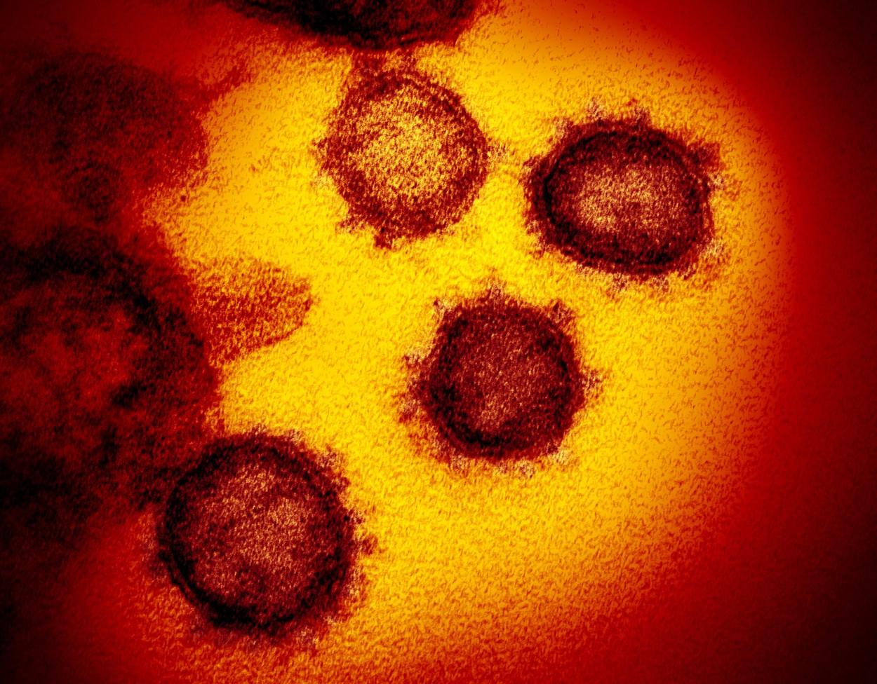 Coronavirus COVID-19, tratat cu un medicament pentru astm! Anunțul făcut de o echipă de medici din Japonia! &bdquo;Am văzut efectul &icirc;n două zile&rdquo;
