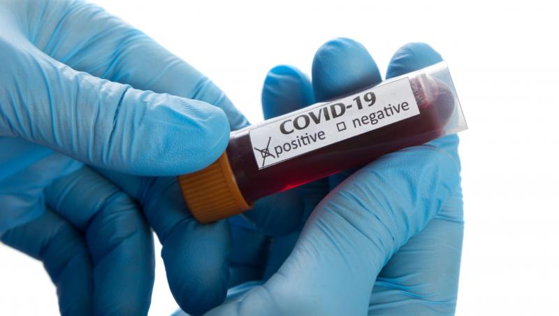 COVID-19 pozitiv? Tot ce trebuie să ştii dacă ai luat coronavirus