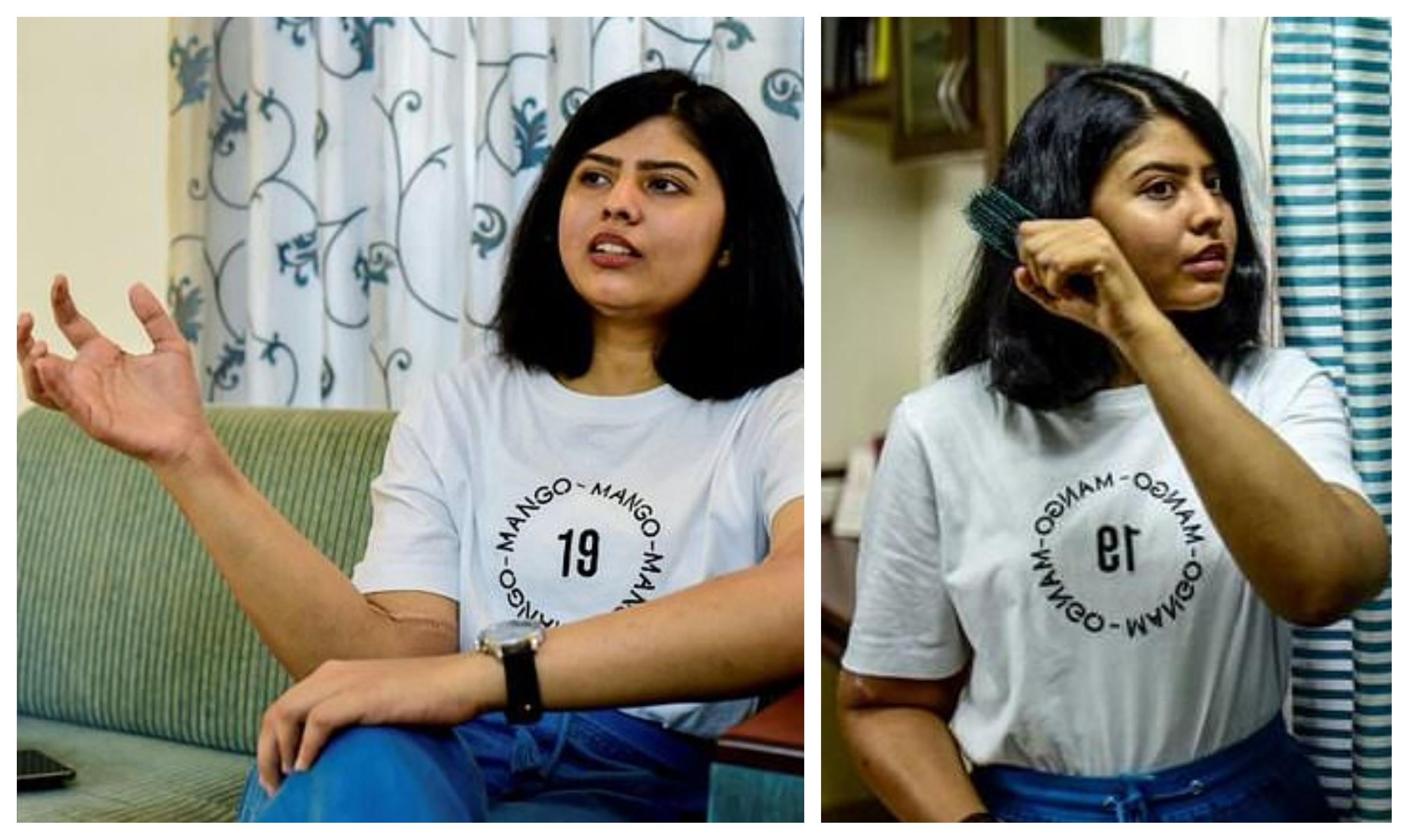 La 19 ani, a primit m&acirc;ini de bărbat, după ce ale ei au fost strivite! Ce s-a &icirc;nt&acirc;mplat după transplant a uimit medicii! &bdquo;Brațele s-au schimbat total!&rdquo; - Foto