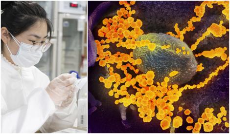 Institutul Flamand de Cercetare a anunțat descoperirea unui anticorp capabil să ucidă COVID-19. Ar putea împiedica noul coronavirus să infecteze celulele umane