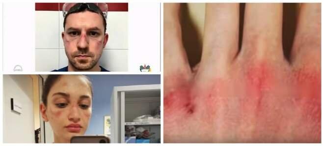 Dezastru! Personalul medical din Italia este dublu infectat cu COVID-19 față de cel din China