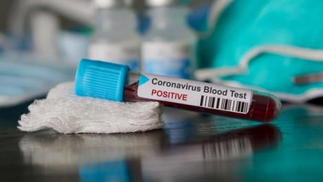 Coronavirusul ucide mai mulți români?! Alexandru Rafila: ”Sunt 650 de persoane care mor zilnic în România. Rămâne să vedem câte se sting din cauza Covid-19”