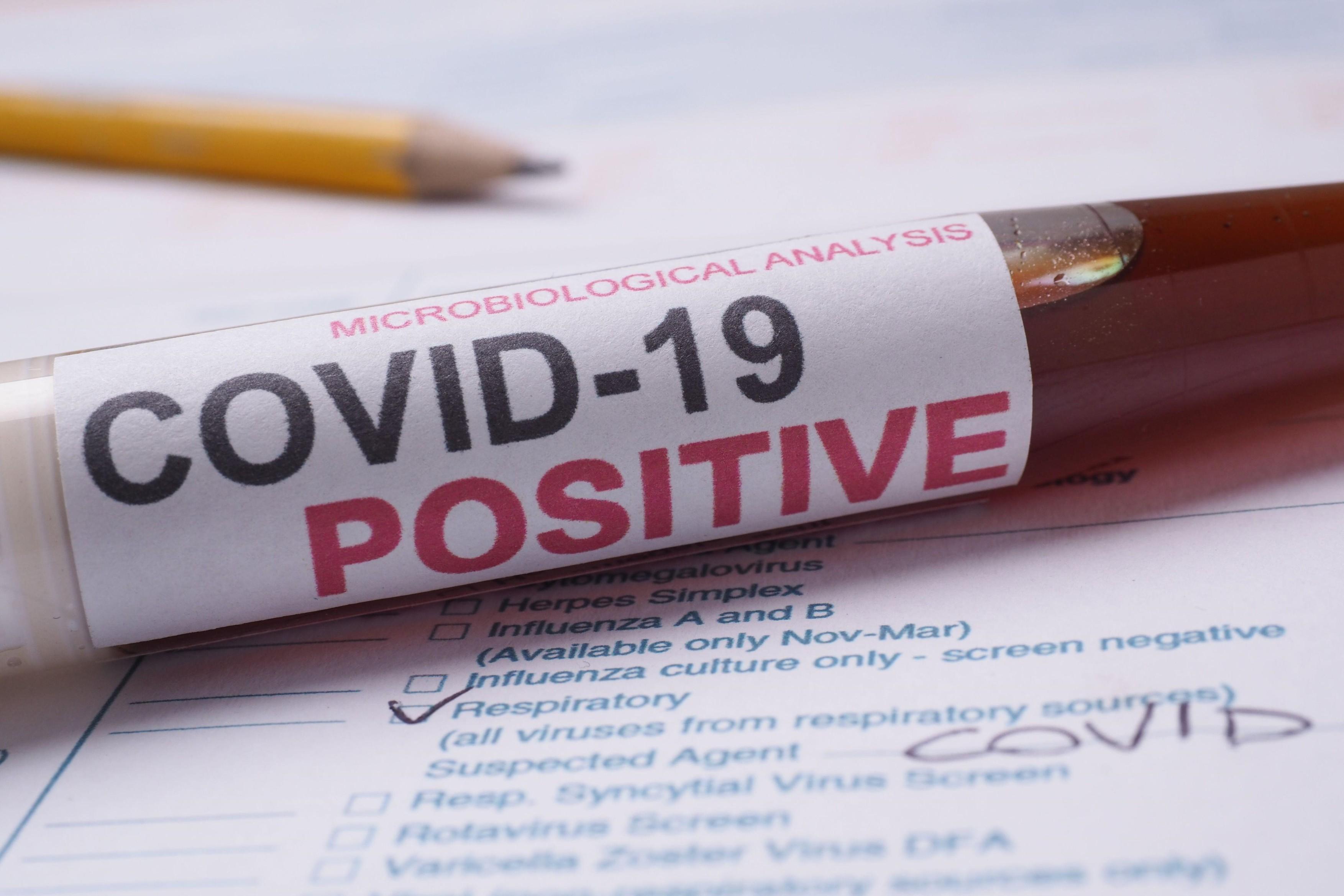 &bdquo;Coronavirusul n-a apărut aşa cum crede lumea&rdquo;. Cum a dob&acirc;ndit COVID-19 &bdquo;puterea&rdquo; de a se transmite la oameni?