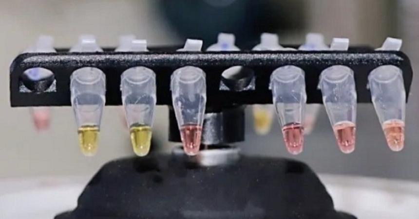 Universitatea Oxford pune la punct teste de depistarea noului coronavirus &icirc;n 30 de minute