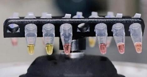 Universitatea Oxford pune la punct teste de depistarea noului coronavirus în 30 de minute