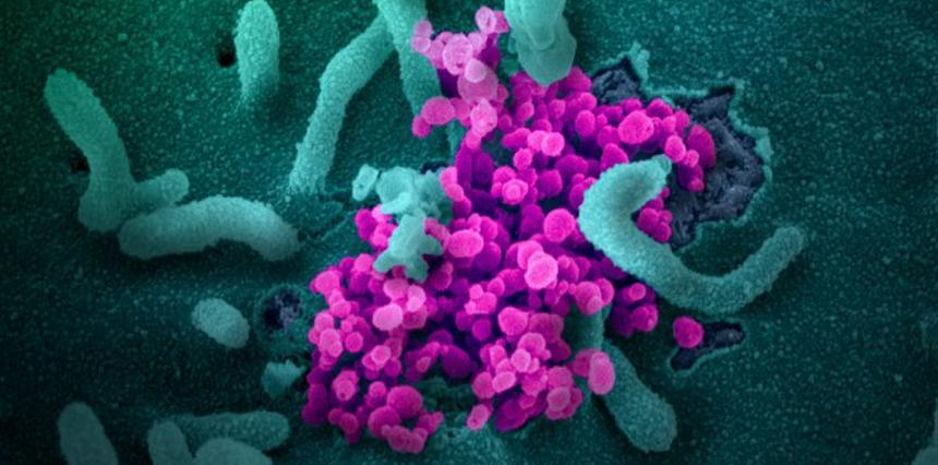 Oboseală, febră, tuse, dureri de cap, pierderea mirosului. Simptomele covid-19, variabile, dar caracteristice